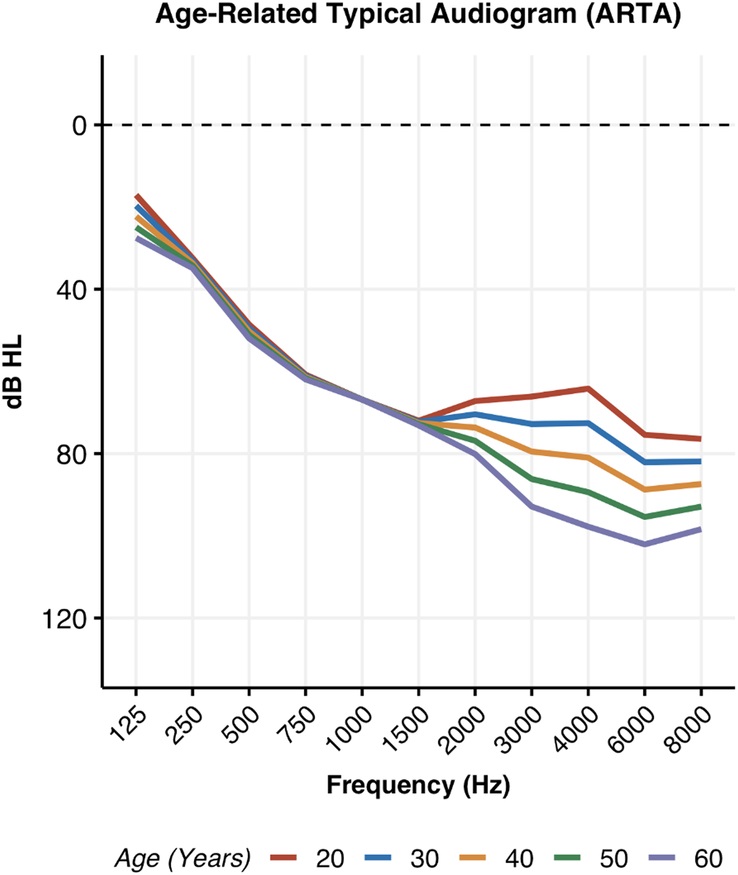 Age-related typical audiograms (ARTA) for all USH2a patients in the CRUSH study, showing a moderate-to-severe sloping hearing loss pattern with mid-to-high frequency progression